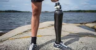 Artificial limbs